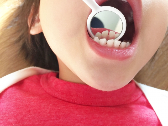 子供の虫歯